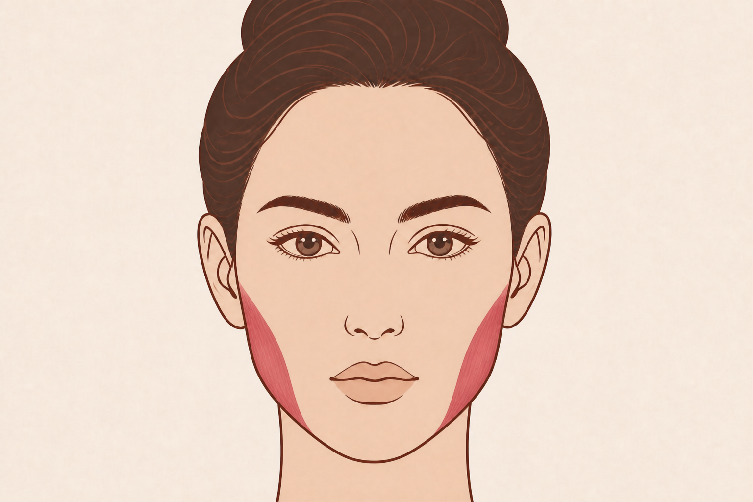 Illustratie van de kaakspieren (masseter) bij botox tegen tandenknarsen
